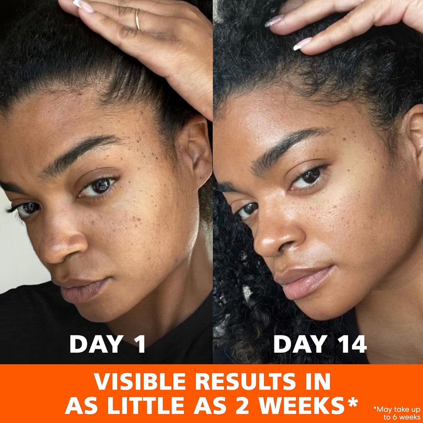 Palmer's_Skin_Success_Anti-Dark_Spot_Fade_Cream_with_Vitamin_E_and_Niacinamide,_for_All_Skin_Types_2.7_Ounce