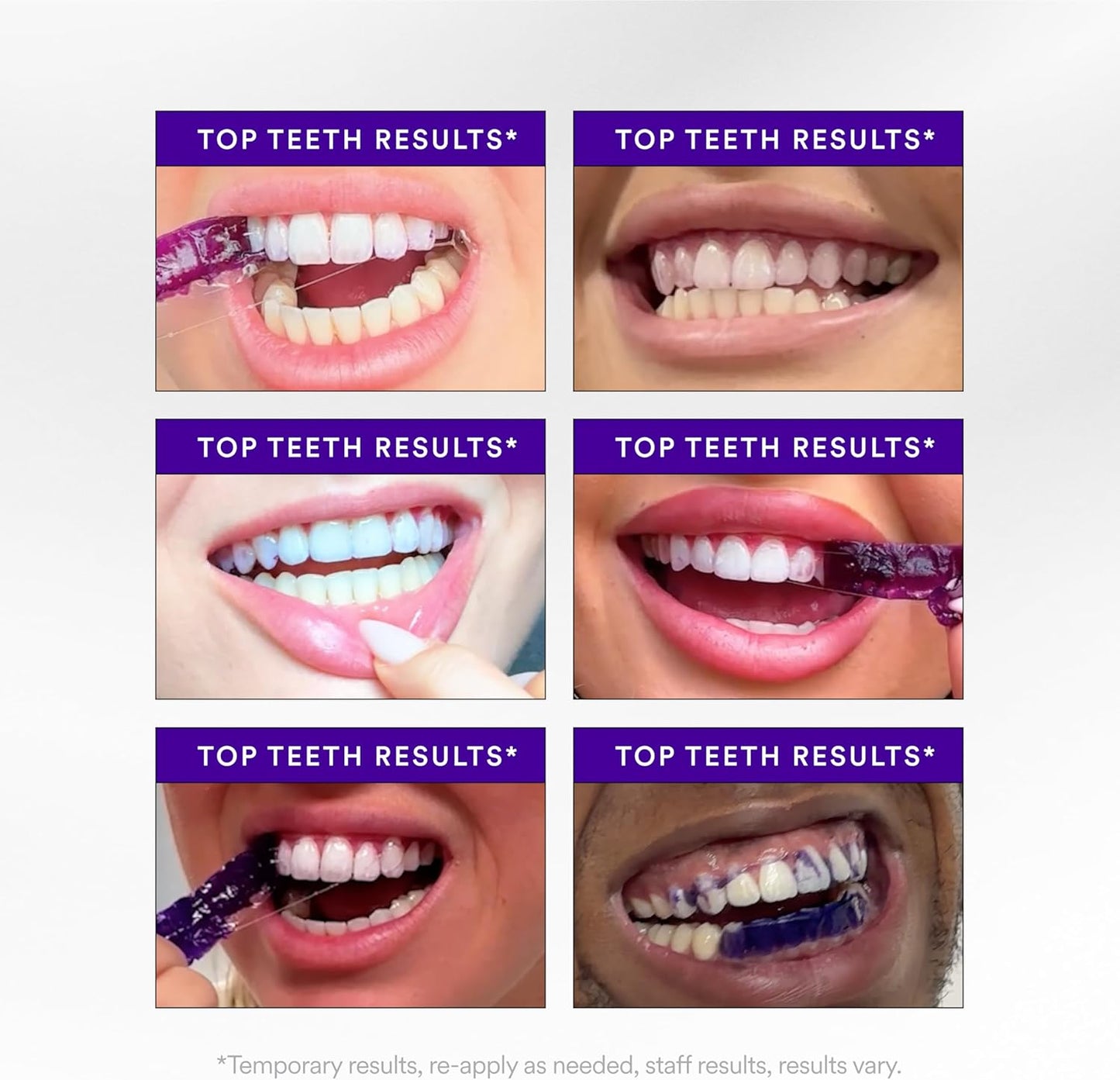 Hismile_V34_Whitening_Strips,_Teeth_Whitening_Strips,_Purple_Tooth_Whitening,_Purple_V34_Whitening_Strips,_Tooth_Stain_Treatment,_Combining_Whitening_and_Colour_Correction