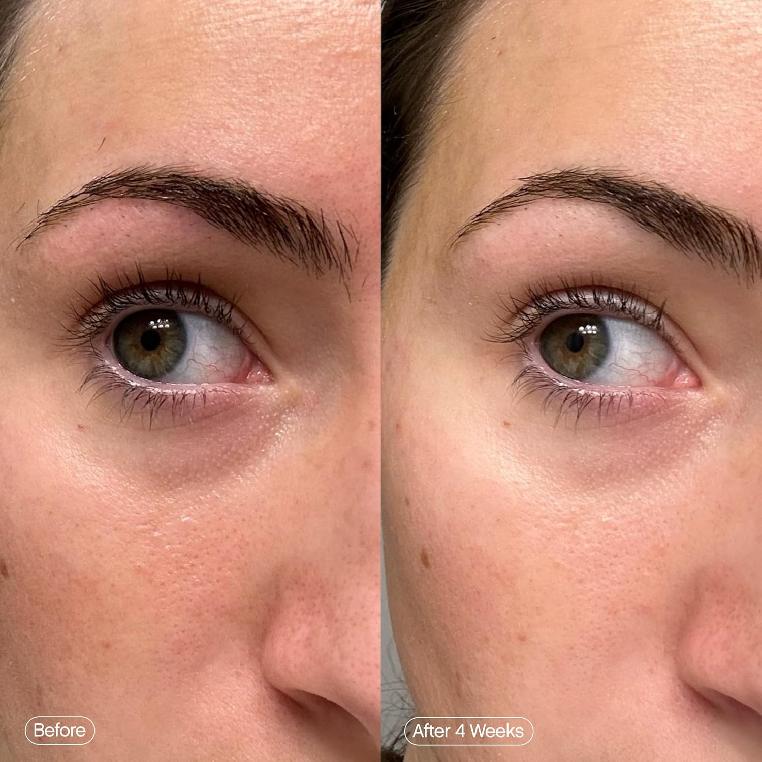 Topicals_Faded_Brightening_Under_Eye_Masks_|_Patches_to_Depuff,_Hydrate,_Brighten_and_Cool_|_Reduce_Dark_Circles_and_Fine_Lines_|_Contains_Kojic_Acid,_Caffeine_and_Niacinamide_(Set_of_6)