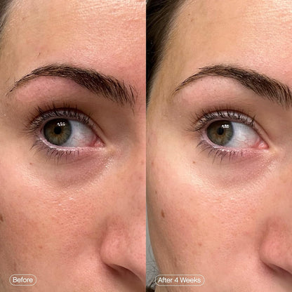 Topicals_Faded_Brightening_Under_Eye_Masks_|_Patches_to_Depuff,_Hydrate,_Brighten_and_Cool_|_Reduce_Dark_Circles_and_Fine_Lines_|_Contains_Kojic_Acid,_Caffeine_and_Niacinamide_(Set_of_6)