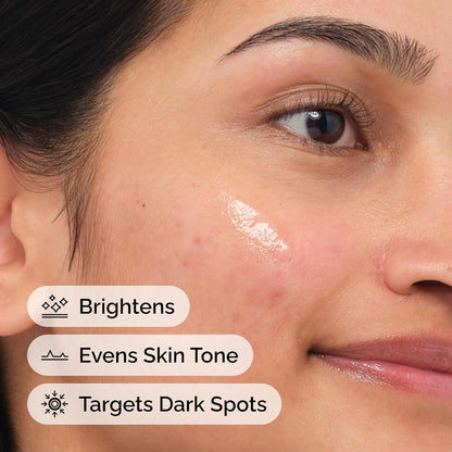 The_Ordinary_Alpha_Arbutin_2%_+_Hyaluronic_Acid,_Brightens_Skin_and_Targets_Dark_Spots,_1_Fl_Oz