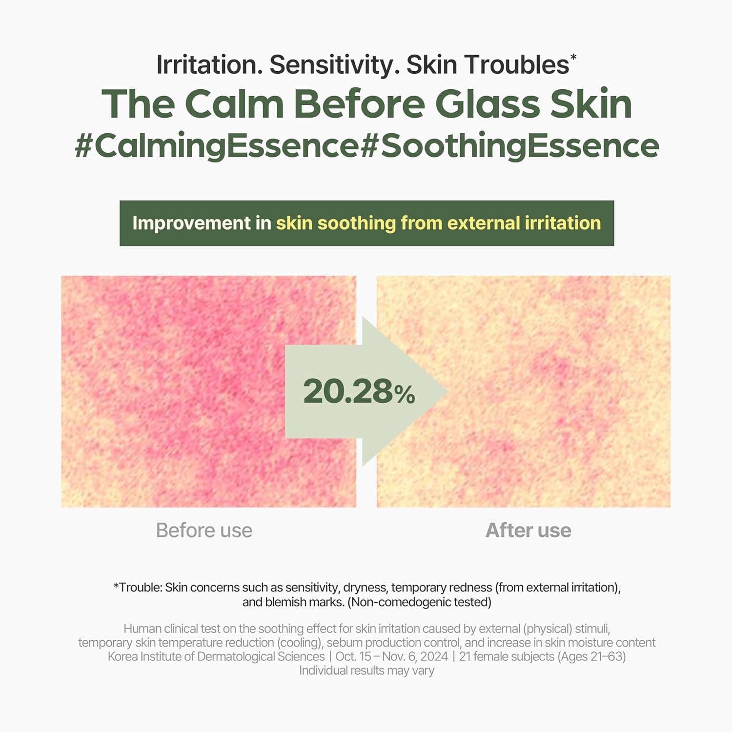 I’m_From_Mugwort_Essence,_Deep_Calming_Essence_for_Sensitive_Skin,_Hydrating_&_Skin_Balancing,_Vegan_Korean_Skin_Care_5.07fl.oz
