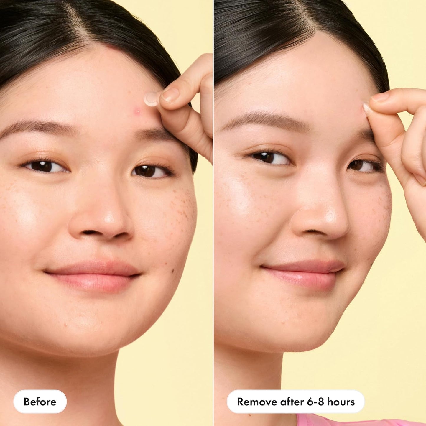 Mighty_Patch_Mini_Invisible+_Patches_-_X-Small_Daytime_Hydrocolloid_Acne_Pimple_Patches_for_Covering_Zits_&_Blemishes,_Blends_Into_Skin_&_Barely_There_(30_Count,_10mm_Patch)