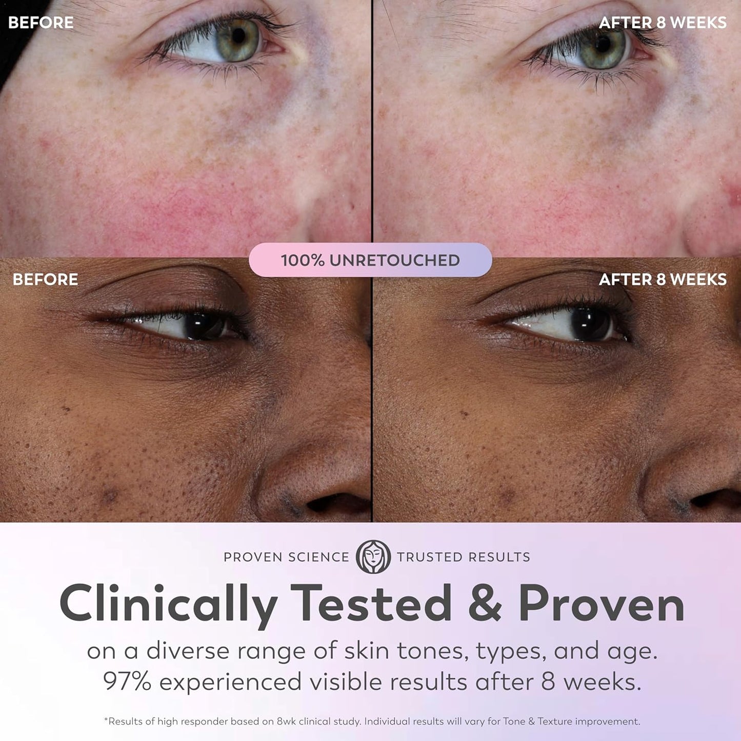 Olay_Super_Serum_-_Glow_Serum_for_Face_-_Activated_Niacinamide,_Vitamin_C_&_E,_Collagen_Peptide,_AHA_-_5-in-1_Benefits_-_Brightens,_Hydrates,_Smooths,_Firms,_Evens_Tone,_Proactive_Anti-Aging,_1.0_Oz