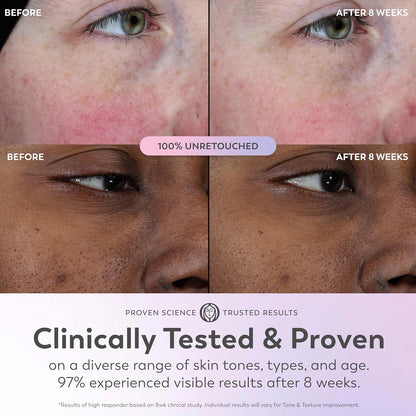 Olay_Super_Serum_-_Glow_Serum_for_Face_-_Activated_Niacinamide,_Vitamin_C_&_E,_Collagen_Peptide,_AHA_-_5-in-1_Benefits_-_Brightens,_Hydrates,_Smooths,_Firms,_Evens_Tone,_Proactive_Anti-Aging,_1.0_Oz