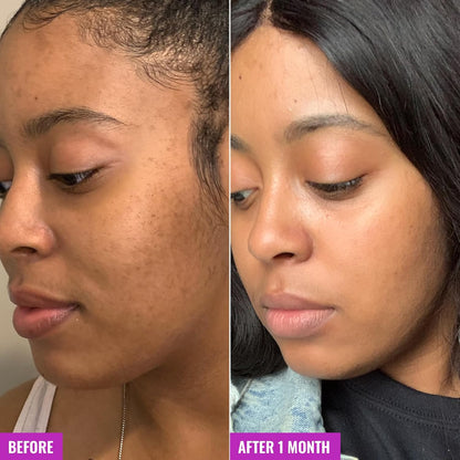 Good_Molecules_Glycolic_Exfoliating_Toner_-_Hyaluronic_and_Glycolic_Acid_Daily_Toner_for_Face_-_Cleansing_Facial_Exfoliant_for_Glowing_Even_Skin_Tone,_Skin_Care
