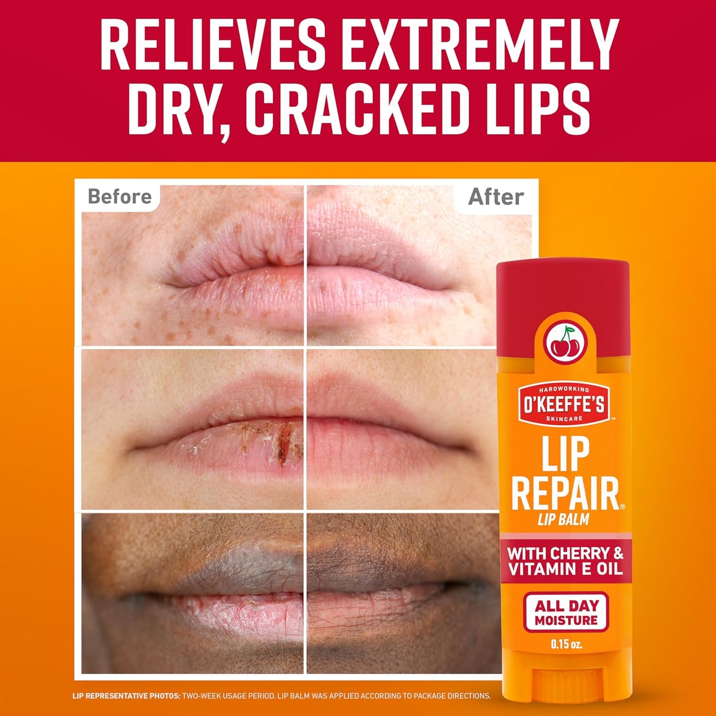O'Keeffe's_Lip_Repair_Lip_Balm_with_Cherry_&_Vitamin_E_Oil_-_Stick_(3_Pack)_-_Moisturizer_for_Extremely_Cracked,_Dry_Lips