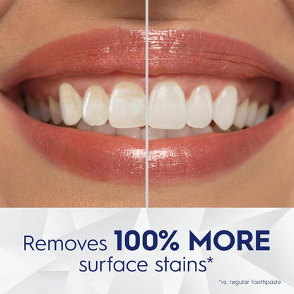 Crest_3D_White_Brilliance_Bright_Mint_Teeth_Whitening_Toothpaste,_4.3_oz_Pack_of_3,_100%_More_Surface_Stain_Removal,_24_Hour_Active_Stain_Prevention,_Whiter_Teeth_in_3_Days