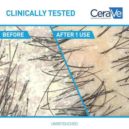 CeraVe_Hydrating_Anti_Dandruff_Shampoo,_1%_Pyrithione_Zinc_Dandruff_Treatment_With_Ceramides,_Niacinamide_&_Hyaluronic_Acid,_Helps_Eliminate_Flakes_&_Provides_Itchy_Scalp_Relief,_Sulfate_Free,_19_Oz