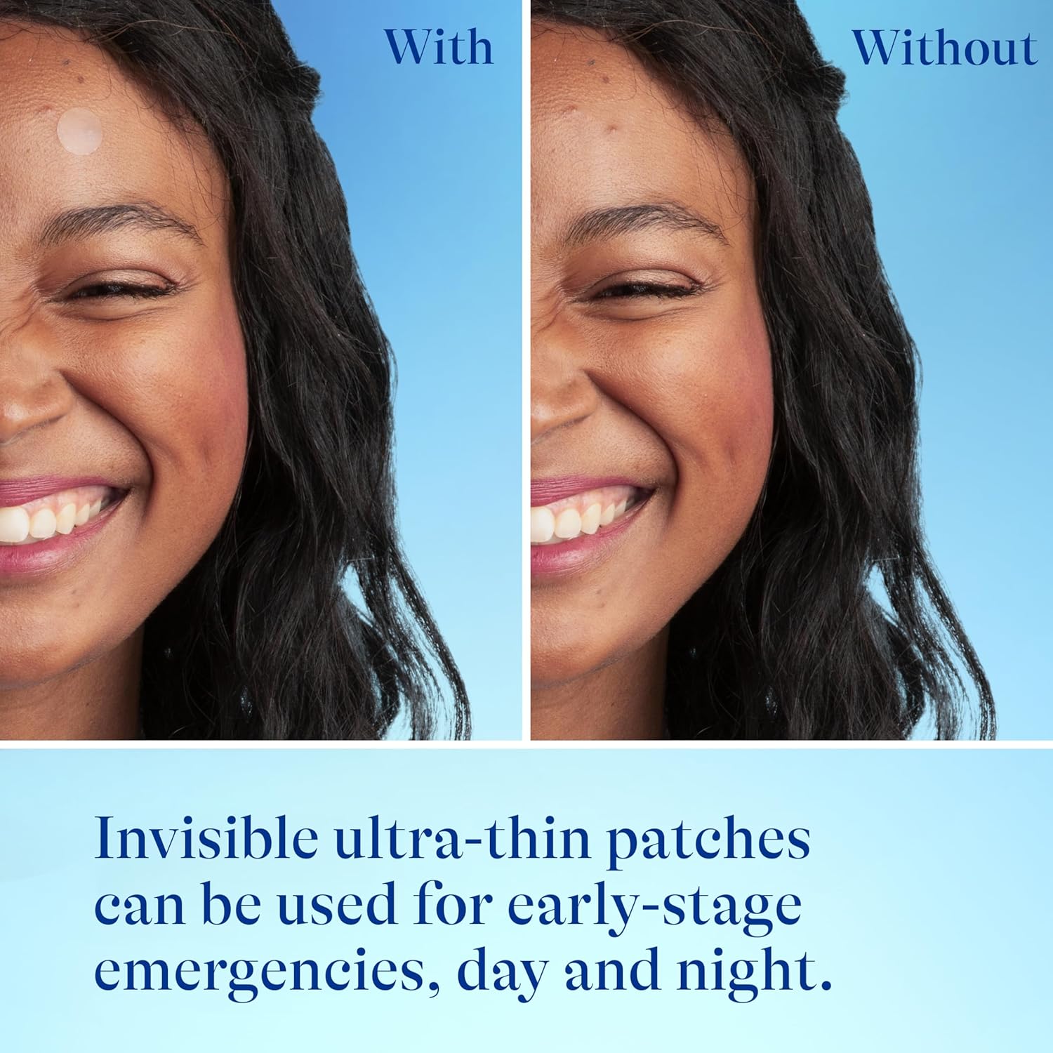 Differin_Acne_Patches,_Pimple_Patches_for_Acne_Prone_Skin,_Formulated_with_Salicylic_Acid_and_Centella,_Fast_Triple_Action_Power_Patch_for_Day_&_Night,_Dermatologist_Tested,_36_Count