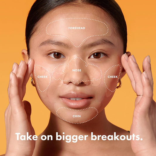 Mighty_Patch_Hero_Cosmetics_Face_Patch_-_XL_Hydrocolloid_Face_Mask_for_Acne,_5_Large_Pimple_Patches_for_Zit_Breakouts_on_Nose,_Chin,_Forehead_&_Cheeks_(1_Count)