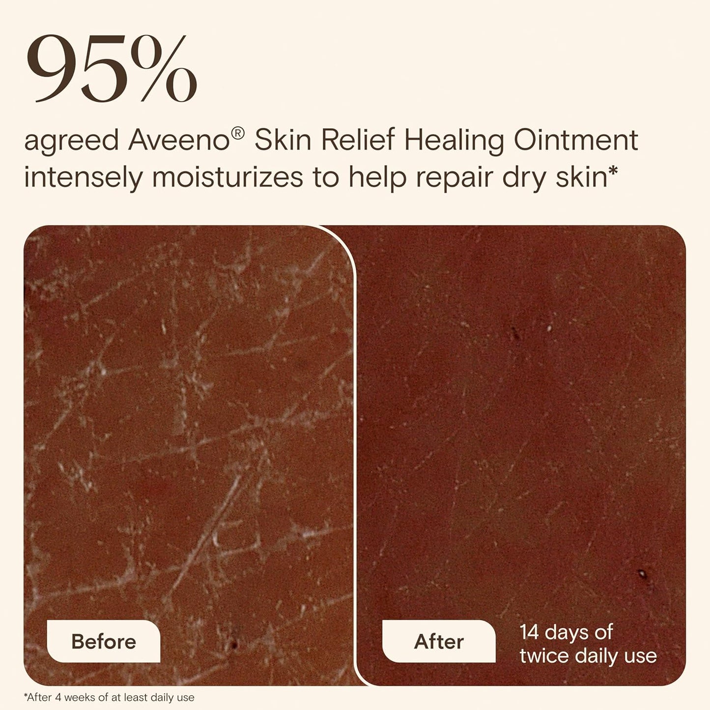 Aveeno_Skin_Relief_Healing_Ointment,_for_Extra_Dry,_Cracked_&_Sensitive_Skin,_72-Hour_Protectant_with_Triple_Oat,_Shea_Butter_&_Glycerin,_Fragrance-Free_for_Body,_Face,_Hands,_Lips_7.2_oz