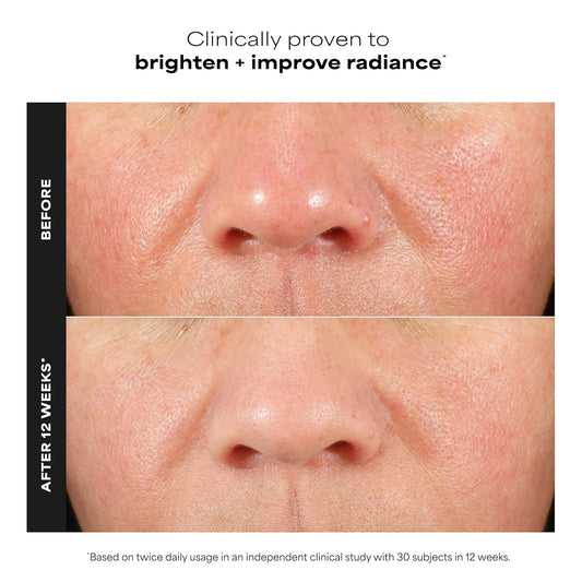 Paula's_Choice_BOOST_C15_Super_Booster,_15%_Vitamin_C_Serum_for_Face,_Face_Serum_with_Vitamin_E_&_Ferulic_Acid_for_Discoloration_&_Glow,_Fragrance-Free