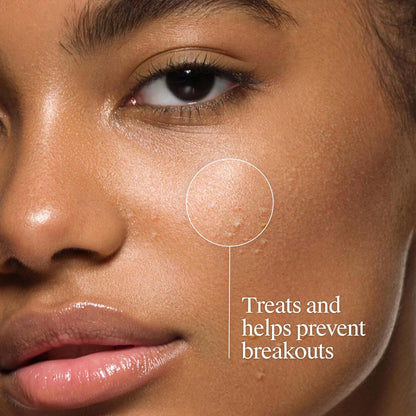 Neutrogena_Oil-Free_Acne_Face_Wash,_Fragrance_Free,_Sensitive_Skin_Facial_Cleanser_with_2%_Salicylic_Acid_Acne_Treatment_for_Face,_9.1_Fl_Oz