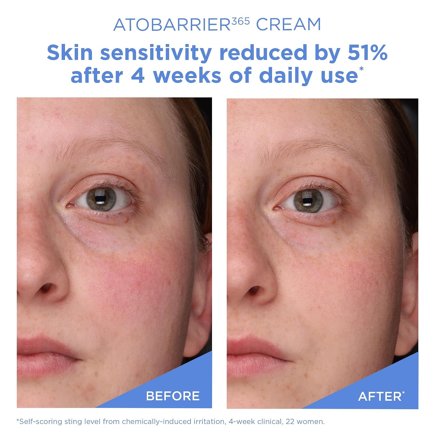 AESTURA_ATOBARRIER365_Cream_with_Ceramides,_Korean_Face_Moisturizer_for_Barrier_Repair_|_120H_lasting_Hydration,_Ceramide_Capsules,_Dry_&_Sensitive_Skin,_Non-comedogenic,_80_mL_/_2.70_fl.oz.