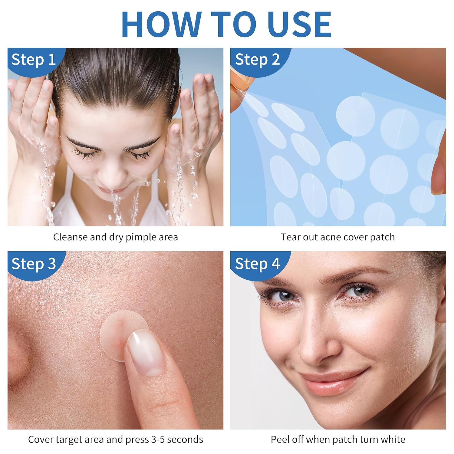 Pimple_Patches_for_Face,_4_Size_300_Counts_Acne_Patches,_Hydrocolloid_Patches_for_Covering_Zits_and_Blemishes,_Spot_Stickers_with_Salicylic_Acid,_Tea_Tree_Oil_&_Calendula_Oil