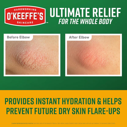 O’Keeffe’s_Skin_Repair_Ultimate_Relief_Body_Cream,_7oz_Tube_(Pack_of_1)_–_for_the_Most_Severe_Dry_Skin