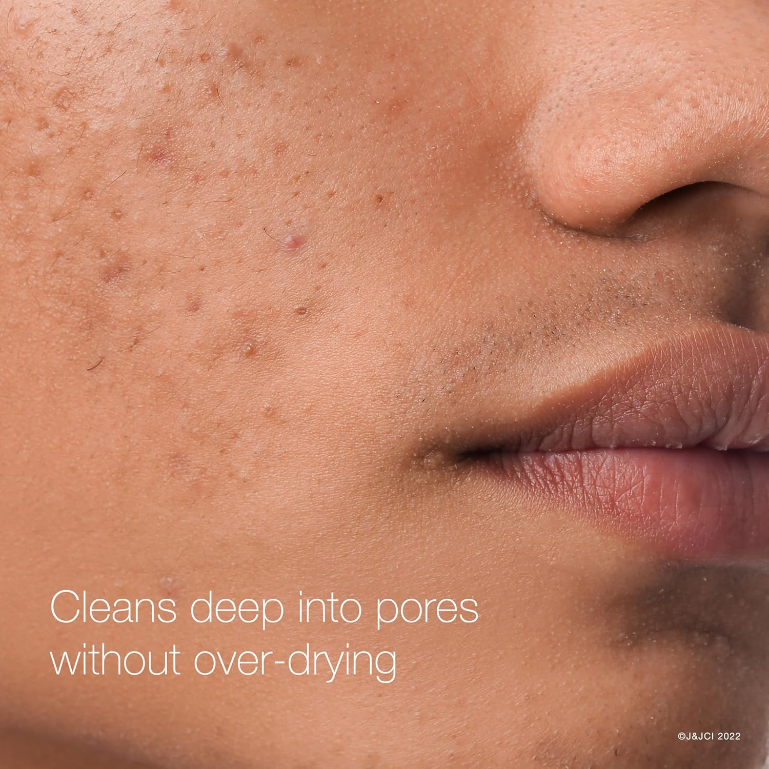 Neutrogena_Rapid_Clear_Maximum_Strength_Acne_Face_Pads_with_2%_Salicylic_Acid_Acne_Medication_to_Help_Fight_Breakouts,_Oil-Free_Facial_Cleansing_Pads_for_Acne-Prone_Skin,_3_Pack