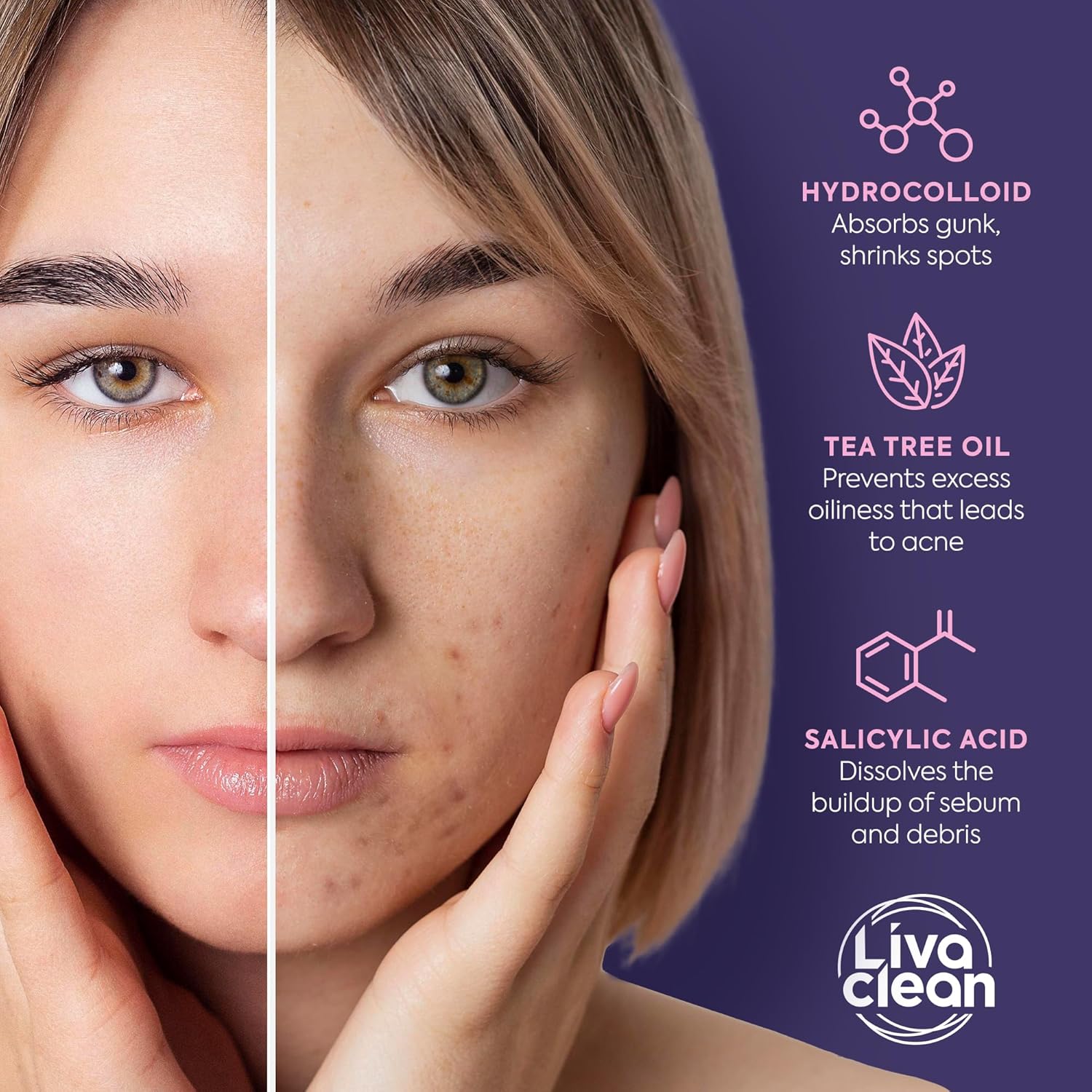 Livaclean_240CT_Star_Pimple_Patches_for_Face_w/_Hydrocolloid,_Tea_Tree_oil_&_Salicylic_Acid_-_Zit_Stickers,_Hydrocolloid_Acne_Patches_for_Face_-_Cute_Pimple_Patch,_Acne_Stickers
