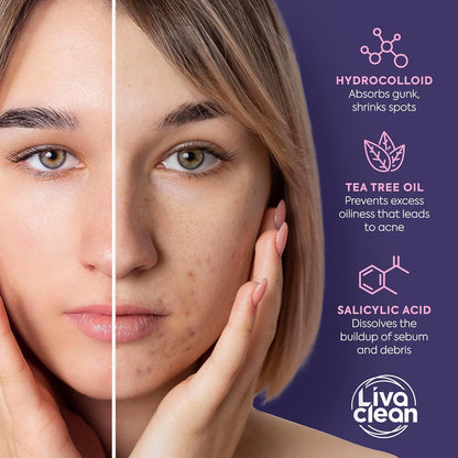 Livaclean_240CT_Star_Pimple_Patches_for_Face_w/_Hydrocolloid,_Tea_Tree_oil_&_Salicylic_Acid_-_Zit_Stickers,_Hydrocolloid_Acne_Patches_for_Face_-_Cute_Pimple_Patch,_Acne_Stickers