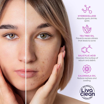 LivaClean_330_CT_Pimple_Patches_for_Face_w/Salicylic_Acid,_Tea_Tree_Oil_&_Calendula_Oil_-_Four_Sizes_-_Pimple_Patch,_Hydrocolloid_Patch,_Acne_Patches_for_Face