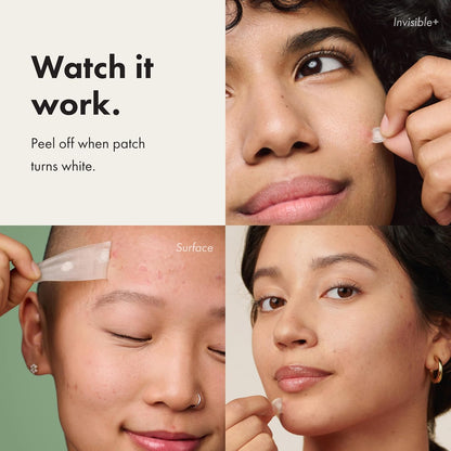 Mighty_Patch™_Variety_Pack_from_Hero_Cosmetics_-_Hydrocolloid_Acne_Pimple_Patches_for_Covering_Zits_and_Blemishes,_Spot_Stickers_for_Face_and_Skin,_Korean_Skin_Care,_26_ct