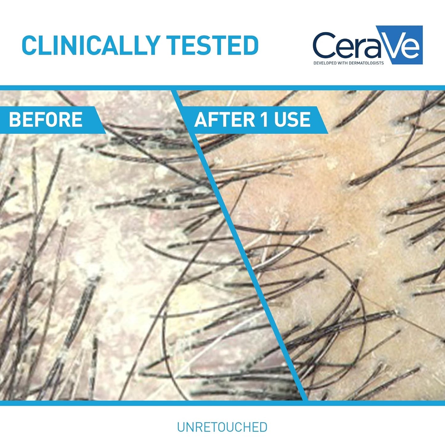 CeraVe_Hydrating_Anti_Dandruff_Conditioner,_0.5%_Pyrithione_Zinc_Dandruff_Treatment_With_Ceramides,_Hyaluronic_Acid_&_Niacinamide,_Helps_Eliminate_Flakes_&_Reduce_Itchy_Scalp,_Sulfate_Free_Conditioner