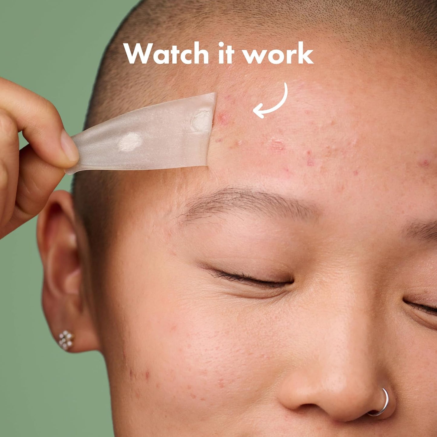 Mighty_Patch_Surface_Large_Pimple_Patches_for_Face,_Acne_Spot_Patch_for_Cheek,_Forehead,_and_Chin,_Pimple_Stickers,_Hydrocolloid_Covers,_Vegan-friendly,_from_Hero_Cosmetics,_10_Count