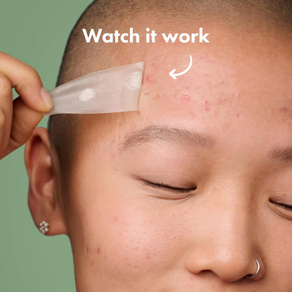 Mighty_Patch_Surface_Large_Pimple_Patches_for_Face,_Acne_Spot_Patch_for_Cheek,_Forehead,_and_Chin,_Pimple_Stickers,_Hydrocolloid_Covers,_Vegan-friendly,_from_Hero_Cosmetics,_10_Count