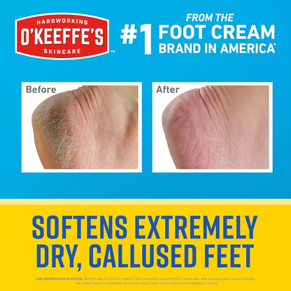 O'Keeffe's_for_Healthy_Feet_Intense_Renewal_Cream_with_Urea_&_Alpha_Hydroxy_Acid_-_3_oz_Tube_(1_Pack)_-_Chemically_Exfoliates_and_Softens_Extremely_Callused,_Dry_Feet