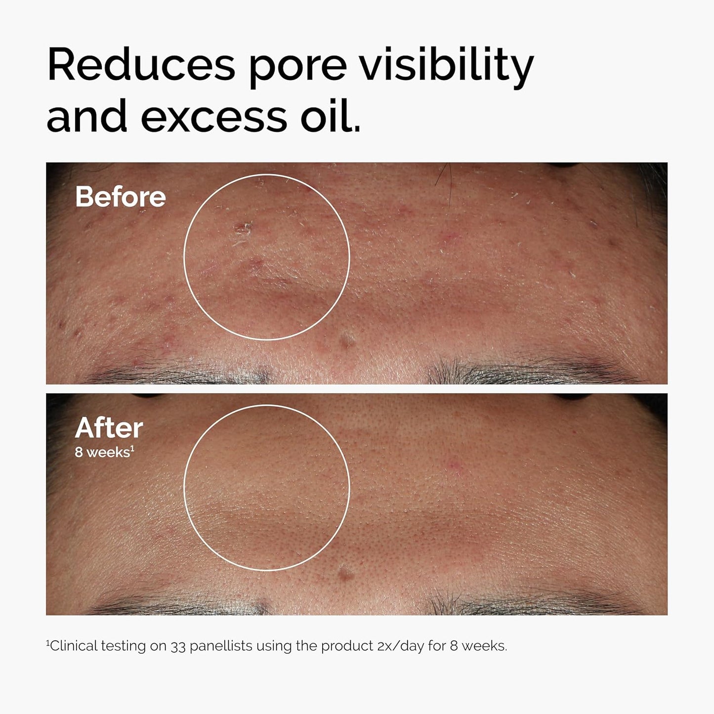 The_Ordinary_Serum_Favorites_Set_–_Hyaluronic_Acid_2%_+_B5,_Niacinamide_10%_+_Zinc_1%,_Caffeine_Solution_5%_–_Eye_and_Face_Serums_for_Hydrating,_Brightening_&_Pore-Minimizing_Skin_Care
