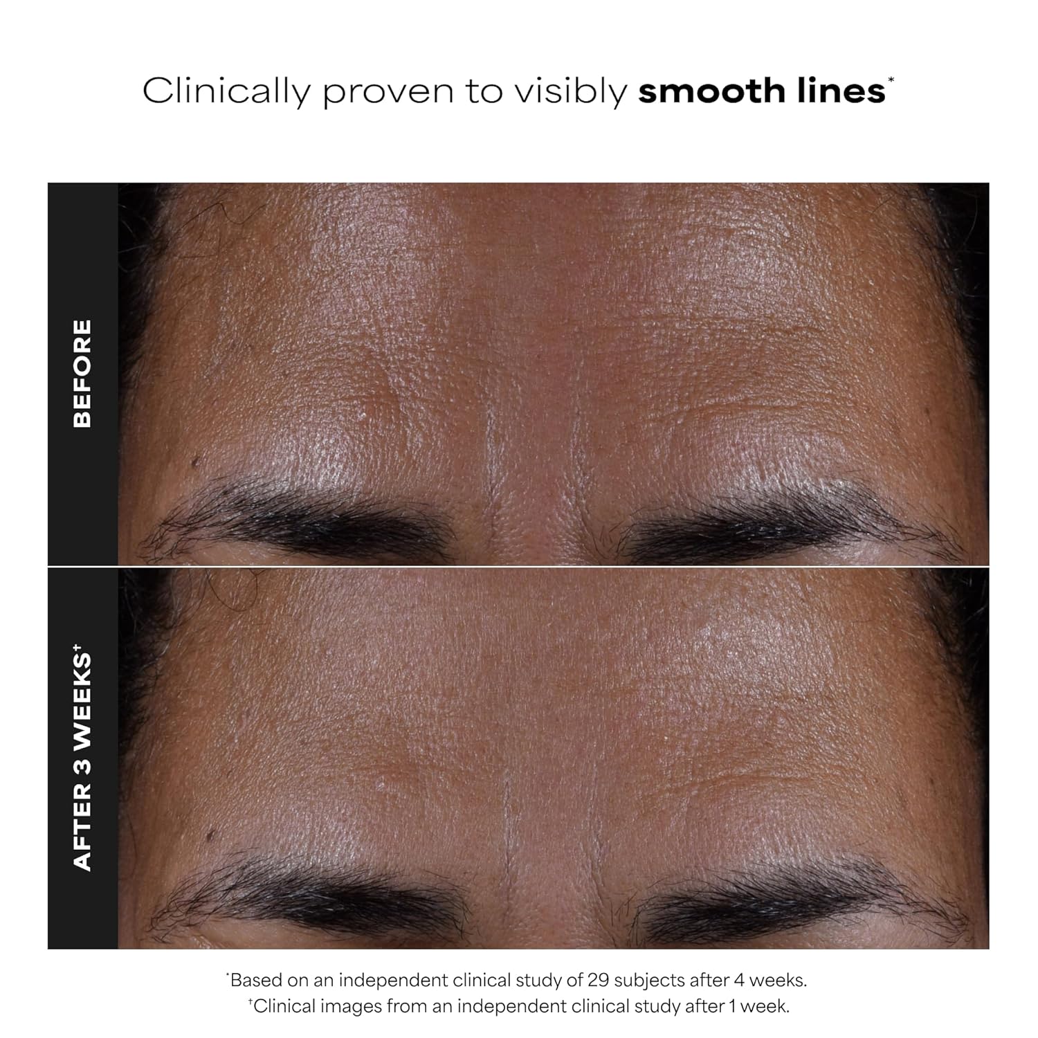 Paula's_Choice_SKIN_PERFECTING_2%_BHA_Salicylic_Acid_Exfoliating_Pads_-_Facial_Exfoliant_Pads_for_Blackheads,_Enlarged_Pores,_Wrinkles_&_Fine_Lines