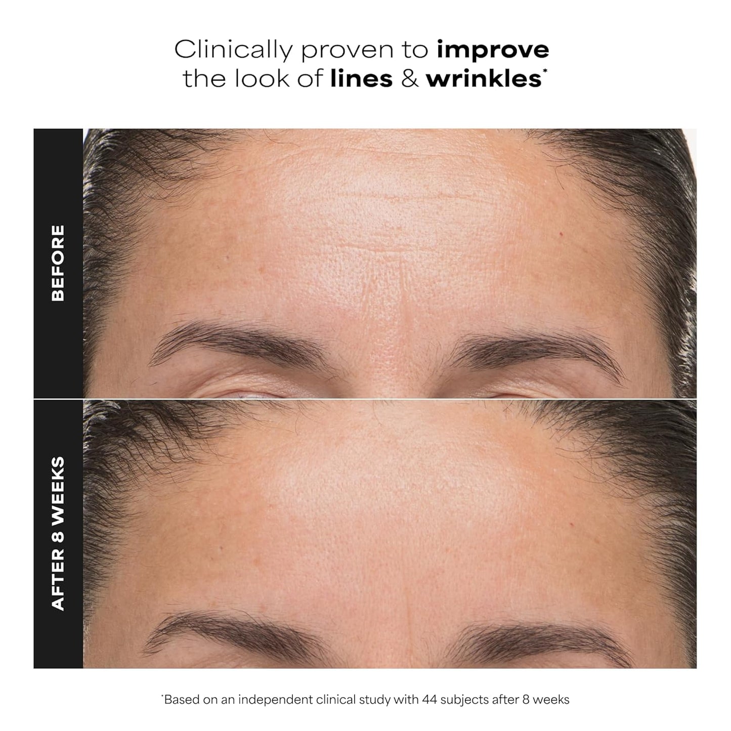 Paula’s_Choice_6%_Mandelic_Acid_+_2%_Lactic_Acid_Exfoliant,_Gentle_Daily_AHA_Exfoliation_for_Discoloration,_Bumpy_Texture_&_Radiance,_for_Sensitive_Skin,_Fragrance-Free
