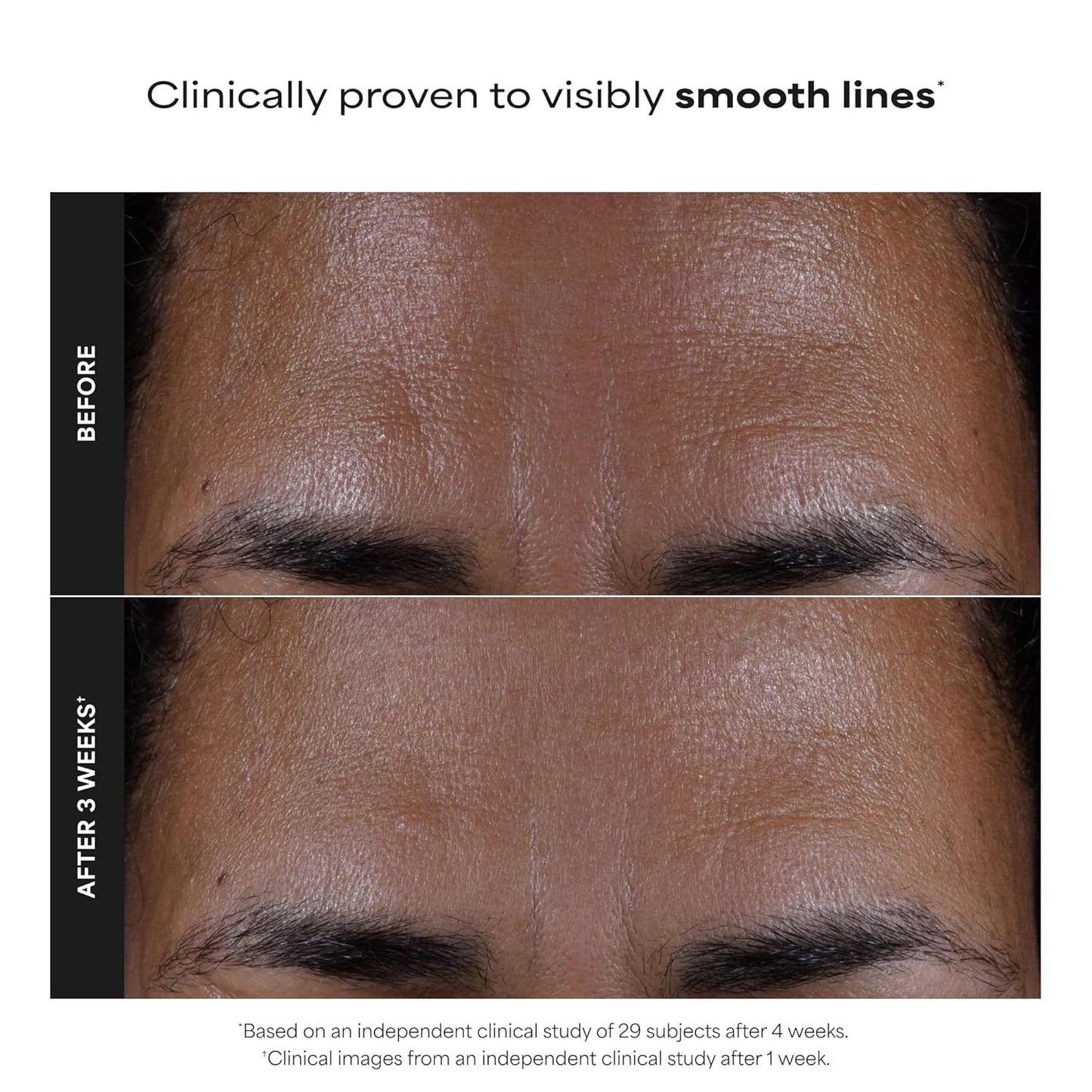 Paula's_Choice_SKIN_PERFECTING_2%_BHA_Liquid_Exfoliant_with_Salicylic_Acid,_Facial_Polish_for_Pores,_Wrinkles_&_Fine_Lines,_Suitable_for_Blackhead-Prone_Skin,_Fragrance-Free