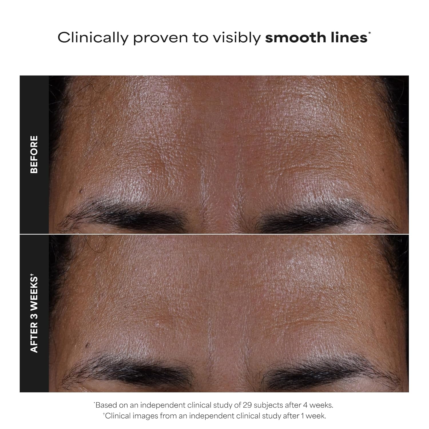 Paula's_Choice_SKIN_PERFECTING_2%_BHA_Liquid_Exfoliant_with_Salicylic_Acid,_Facial_Polish_for_Pores,_Wrinkles_&_Fine_Lines,_Suitable_for_Blackhead-Prone_Skin,_Fragrance-Free