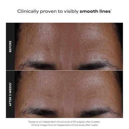 Paula's_Choice_SKIN_PERFECTING_2%_BHA_Liquid_Exfoliant_with_Salicylic_Acid,_Facial_Polish_for_Pores,_Wrinkles_&_Fine_Lines,_Suitable_for_Blackhead-Prone_Skin,_Fragrance-Free