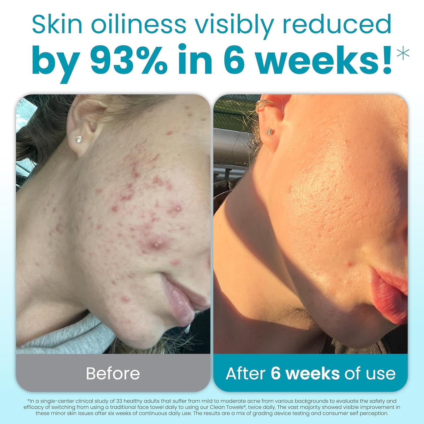 CLEAN_SKIN_CLUB_Blemish_Control_Clean_Towels®_XL,_Extra_Exfoliation_for_Oily_Skin,_Disposable,_Single-Use_Face_Towelette_Dry_Wipe_-_1_Pack_(50_Count)
