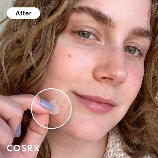 COSRX_Acne_Pimple_Patch_Absorbing_Hydrocolloid_Original_3_Size_Patches_for_Blemishes_and_Zits_Cover,_Spot_Stickers_for_Face_and_Body,_Not_Tested_on_Animals_(240)