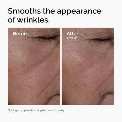 The_Ordinary_Multi-Peptide_+_Hyaluronic_Acid,_Anti-Aging_Peptide_Serum_for_Crow’s_Feet,_Elasticity_&_Firmness,_1_Fl_Oz