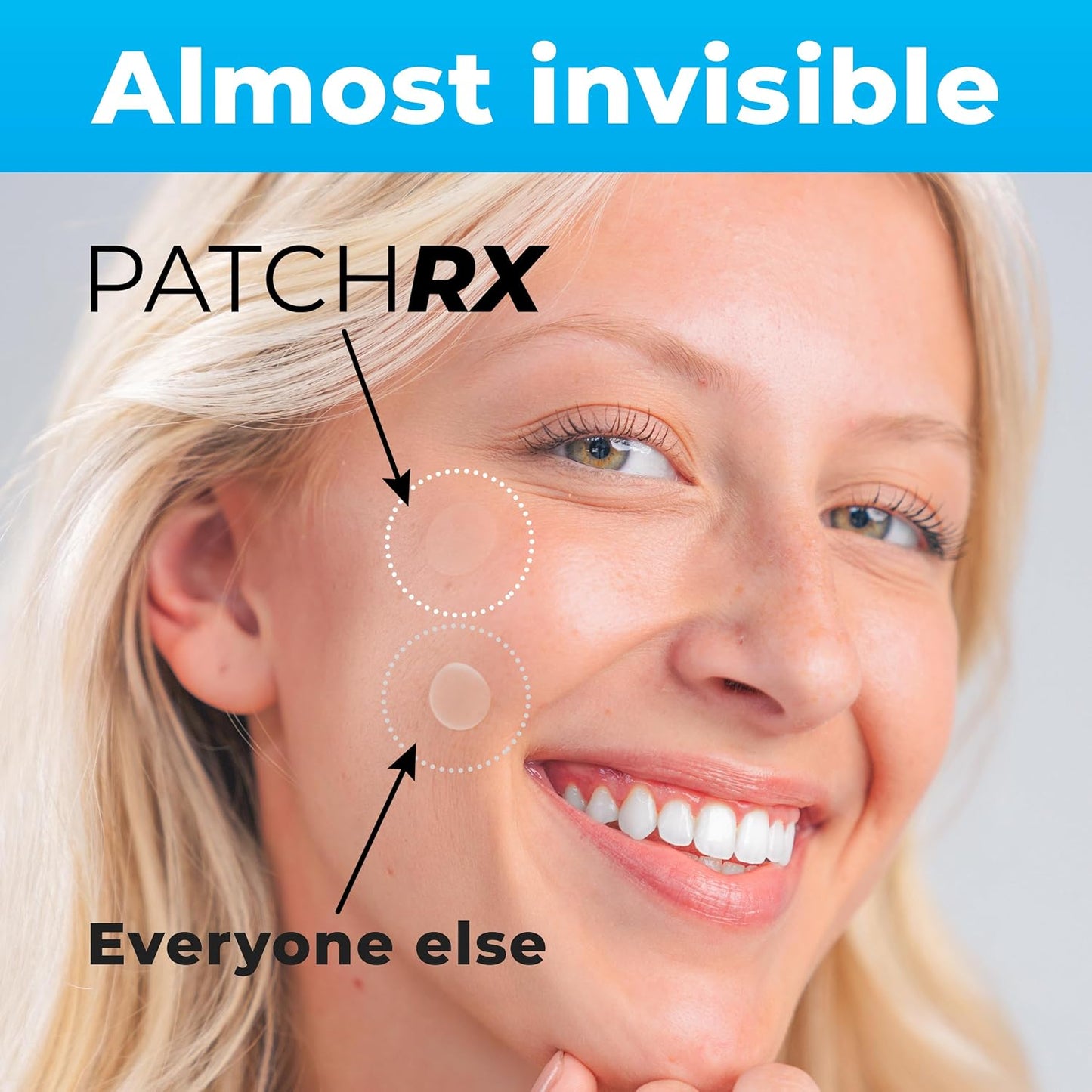 PatchRx_Pimple_Patches_for_Face_(120_Patches),_Hydrocolloid_Acne_Patches_with_Tea_Tree_Oil,_Pimple_Patch_Pimple_Stickers_-_Hydrocolloid_Patch_Acne_Dots_-_Acne_Pimple_Patches_For_Face_-_Zit_Patches