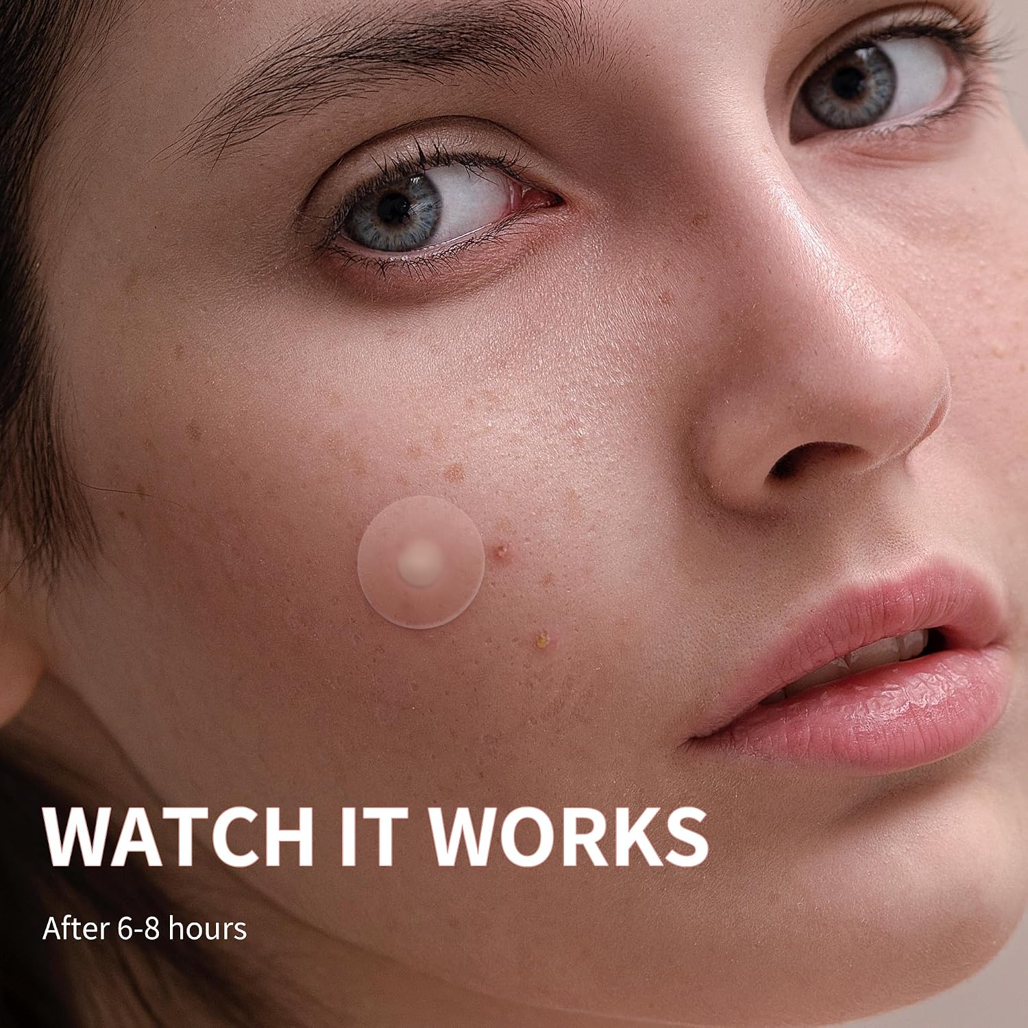 Pimple_Patches_for_Face,_4_Size_300_Counts_Acne_Patches,_Hydrocolloid_Patches_for_Covering_Zits_and_Blemishes,_Spot_Stickers_with_Salicylic_Acid,_Tea_Tree_Oil_&_Calendula_Oil