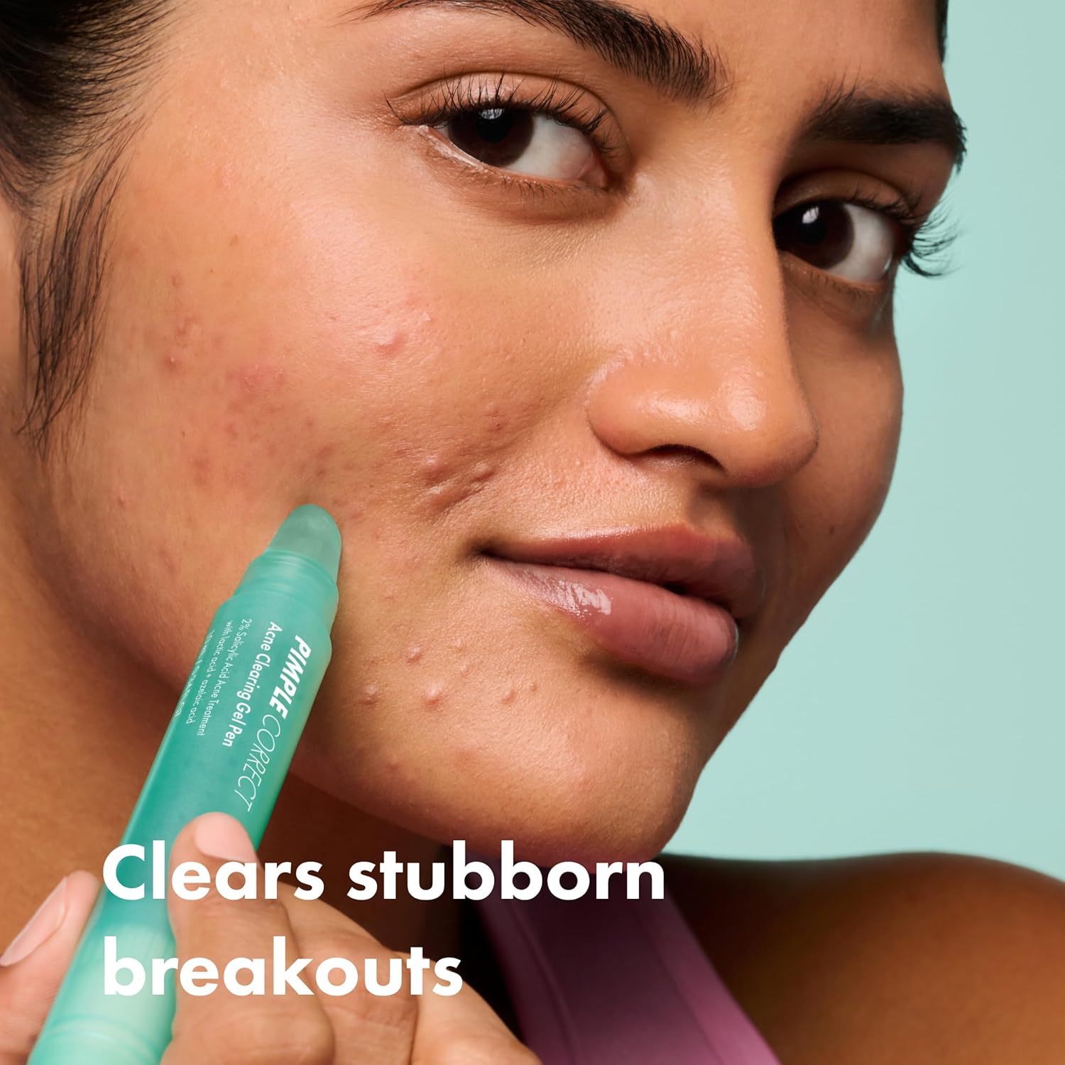 Hero_Cosmetics_Pimple_Correct_Acne_Clearing_Gel_Pen_-_Maximum_Strength_2%_Salicylic_Acid,_Derm-Tested_Formula_for_Current_and_Future_Zits_(1_Count)