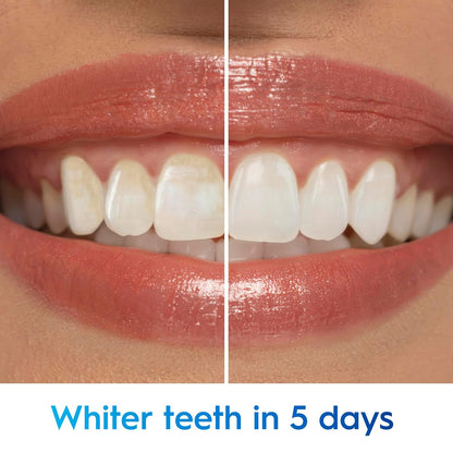 Crest_3D_White_Advanced,_Teeth_Whitening_Toothpaste_for_Adults,_3.7_oz,_4_Pack,_Cavity_Protection_Fluoride_Toothpaste,_Strengthens_Enamel,_Travel_Size_Toiletries