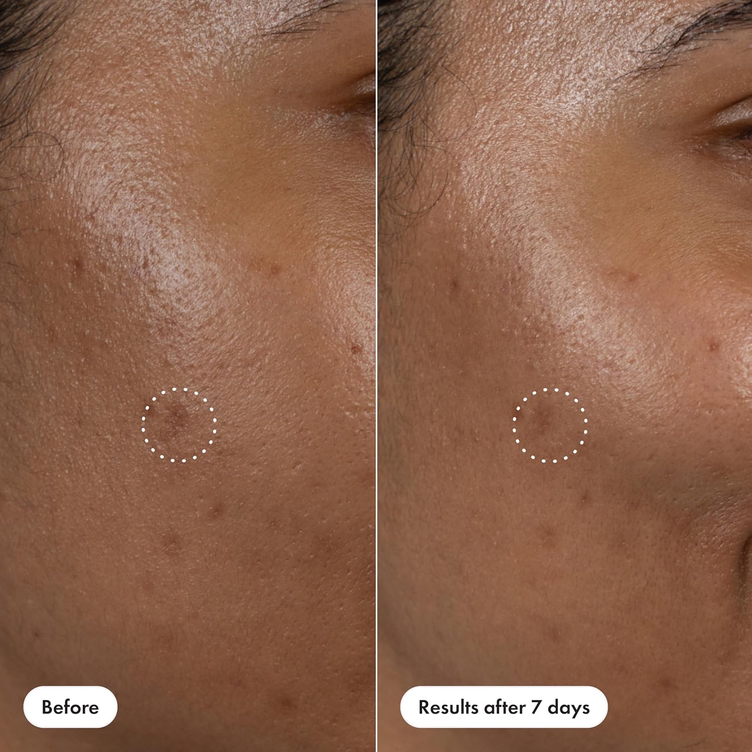 Hero_Cosmetics_Dark_Spot_Correct_Spot-Fading_15%_Vitamin_C_plus_Hyaluronic_Acid_Serum._Improves_the_Look_of_Post_Blemish_Marks_in_7_Days._Twist_Applicator_and_Rollerball_Tip_for_Easy_Application._10mL