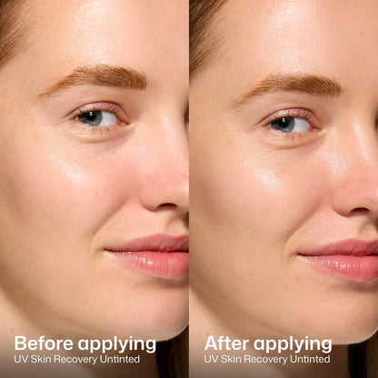 EltaMD_UV_Skin_Recovery_Face_Sunscreen_with_Zinc_Oxide,_All_Mineral,_Safe_for_Sensitive_Skin_SPF_50