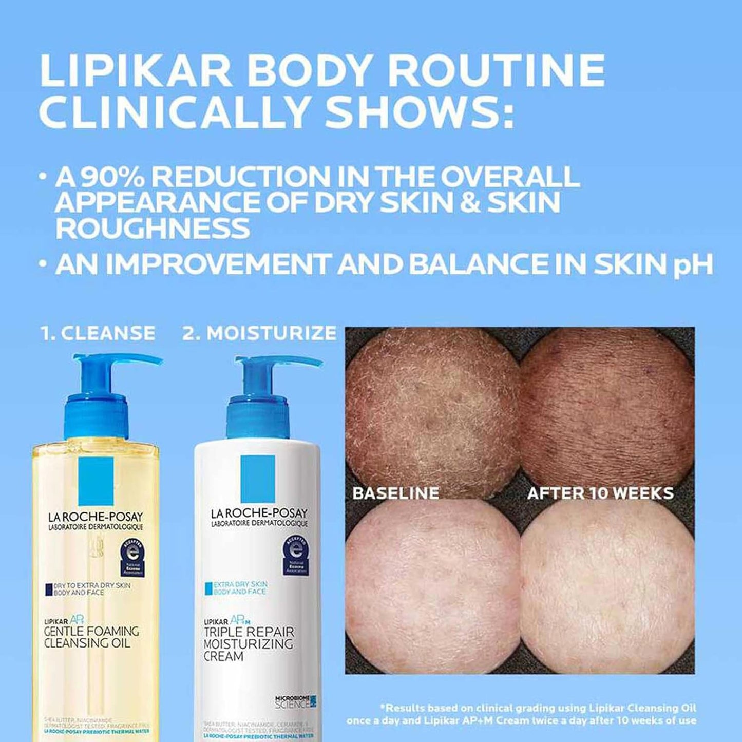 La_Roche-Posay_Lipikar_AP+_Gentle_Foaming_Cleansing_Oil,_Gentle_Oil_Cleanser_for_Face_and_Body_Formulated_with_Niacinamide,_Long-Lasting_24-hour_Hydration,_Fragrance-Free_&_Soap_Free