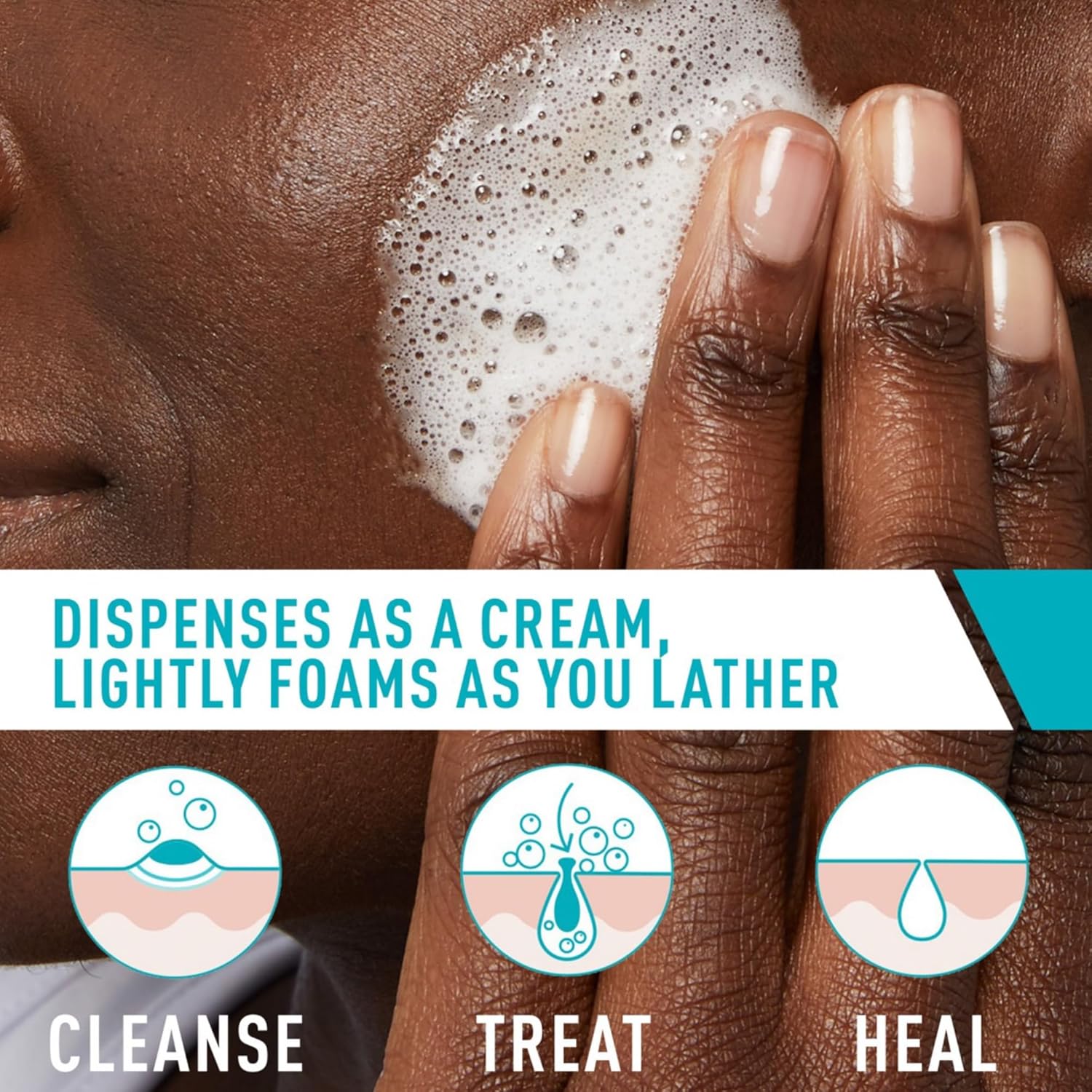 CeraVe_Acne_Foaming_Cream_Cleanser,_4%_Benzoyl_Peroxide_Face_Wash_With_Hyaluronic_Acid,_Niacinamide_&_Ceramides,_Gentle_Daily_Acne_Treatment_For_Face