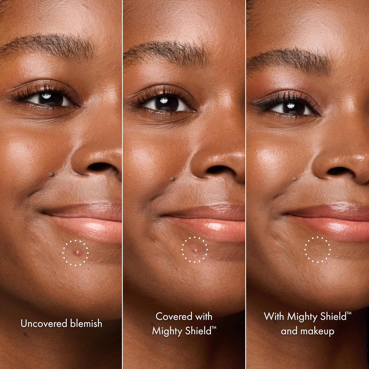 HERO_COSMETICS_Mighty_Shield™_Liquid_Patch_Invisible_Blemish_Protectant_for_Pimples,_Zits,_and_Blemish_Wounds._Fast-Drying_and_Protects_Blemishes_from_Makeup,_Sunscreen