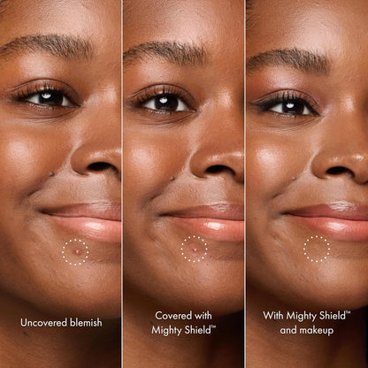 HERO_COSMETICS_Mighty_Shield™_Liquid_Patch_Invisible_Blemish_Protectant_for_Pimples,_Zits,_and_Blemish_Wounds._Fast-Drying_and_Protects_Blemishes_from_Makeup,_Sunscreen
