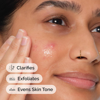 The_Ordinary_Salicylic_Acid_2%_Anhydrous_Solution,_Gentle_Exfoliating_Serum_for_Blemish-Prone_Skin_and_Uneven_Texture